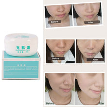 Strong effects Powerful whitening Freckle cream 40g Remove melasma Acne Spots pigment Melanin face care cream NW