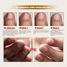 30ml Brand Health Skin Care Herbal Nail Repair Treatment Essential Oil Onychomycosis Remover Serum Beauty Disinfect NW