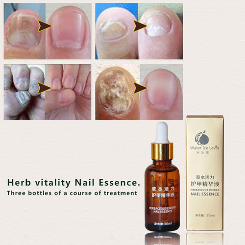 30ml Brand Health Skin Care Herbal Nail Repair Treatment Essential Oil Onychomycosis Remover Serum Beauty Disinfect NW