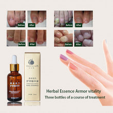 30ml Brand Health Skin Care Herbal Nail Repair Treatment Essential Oil Onychomycosis Remover Serum Beauty Disinfect NW