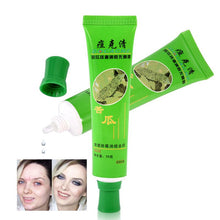 Acne cream blain products desalt blain to imprint face cream 30g LZH7 NW