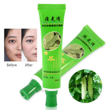 Acne cream blain products desalt blain to imprint face cream 30g LZH7 NW