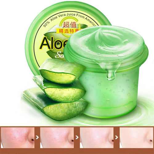Perfect aloe vera gel to blain to imprint blain scar concave hole acne cream 120g Hot NW