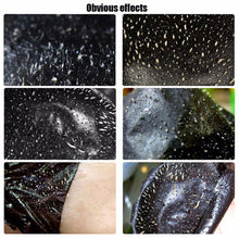 Pig Nose blackhead remover mask suction black mask deep cleansing black head anti acne treatments face masks whitening skin care NW