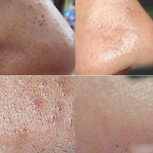 Shrinkage Of Bamboo Charcoal Wash Facial Mask Black Pores Carry Bright Color Skin Moisturizing NW