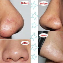 Suction Black Masks Deep Cleansing Purifying Remove Blackhead Nose Skin Care Mask Suction Whitening Mud Cream Black Head Pilaten NW